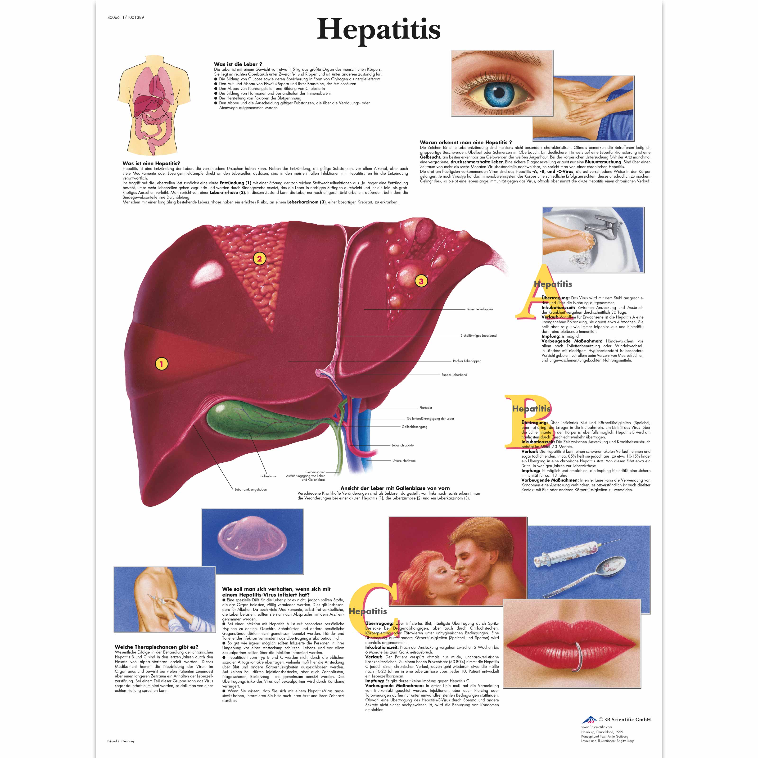 Hepatitis 4006611 VR0435UU Sistema Metabolico 3B Scientific   VR0435UU 01 3200 3200 Hepatitis 